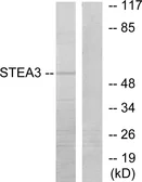 Anti-STEAP3 antibody used in Western Blot (WB). GTX87995