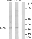 Anti-SIX6 antibody used in Western Blot (WB). GTX87996