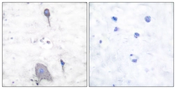 Anti-SIRP alpha antibody used in IHC (Paraffin sections) (IHC-P). GTX87997