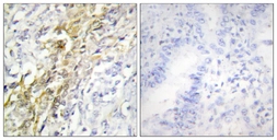 Anti-Casein Kinase 1 alpha antibody used in IHC (Paraffin sections) (IHC-P). GTX88000