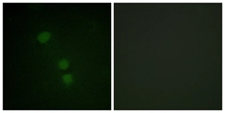 Anti-Histone H2BK15ac (acetyl Lys15) antibody used in Immunocytochemistry/ Immunofluorescence (ICC/IF). GTX88002