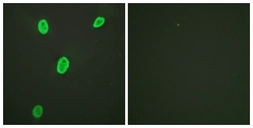 Anti-Histone H4K12ac (acetyl Lys12) antibody used in Immunocytochemistry/ Immunofluorescence (ICC/IF). GTX88003