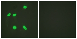 Anti-Histone H4K16ac (acetyl Lys16) antibody used in Immunocytochemistry/ Immunofluorescence (ICC/IF). GTX88004