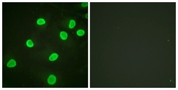 Anti-Histone H4K5ac (acetyl Lys5) antibody used in Immunocytochemistry/ Immunofluorescence (ICC/IF). GTX88005