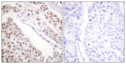 Anti-Histone H2BK12ac (acetyl Lys12) antibody used in IHC (Paraffin sections) (IHC-P). GTX88011