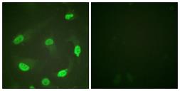 Anti-p53 (acetyl Lys379) antibody used in Immunocytochemistry/ Immunofluorescence (ICC/IF). GTX88013