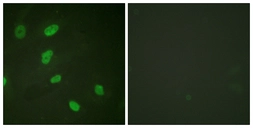 Anti-Histone H2BK5ac (acetyl Lys5) antibody used in Immunocytochemistry/ Immunofluorescence (ICC/IF). GTX88015