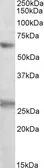 Anti-eIF2B delta antibody, Internal used in Western Blot (WB). GTX88019