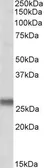 Anti-SNAP23 antibody, Internal used in Western Blot (WB). GTX88021
