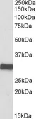 Anti-ETFA antibody, C-term used in Western Blot (WB). GTX88023