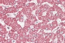 Anti-ETFB (aa 231-243) antibody, C-term used in IHC (Paraffin sections) (IHC-P). GTX88024