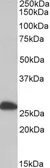 Anti-ETFB (aa 152-165) antibody, Internal used in Western Blot (WB). GTX88025
