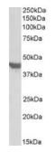 Anti-GLUT4 antibody, C-term used in Western Blot (WB). GTX88031