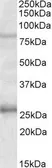Anti-GPRIN3 antibody, Internal used in Western Blot (WB). GTX88035