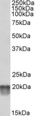 Anti-NDUFS7 antibody, Internal used in Western Blot (WB). GTX88036