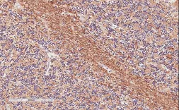 Anti-TPPP antibody, Internal used in IHC (Paraffin sections) (IHC-P). GTX88044