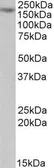 Anti-MYO5A antibody, Internal used in Western Blot (WB). GTX88050