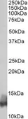 Anti-Phospholamban antibody, N-term used in Western Blot (WB). GTX88052