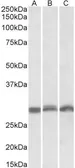Anti-PSMA4 antibody, Internal used in Western Blot (WB). GTX88053