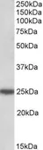 Anti-ARHGDIG antibody, C-term used in Western Blot (WB). GTX88058