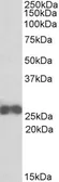 Anti-ARHGDIB antibody, N-term used in Western Blot (WB). GTX88059