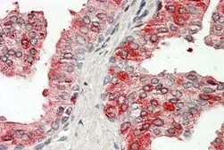 Anti-Prostatic Acid Phosphatase antibody, Internal used in IHC (Paraffin sections) (IHC-P). GTX88063