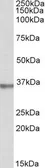 Anti-SPON2 antibody, Internal used in Western Blot (WB). GTX88064