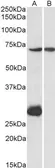 Anti-CPT2 (aa141-154) antibody, Internal used in Western Blot (WB). GTX88067