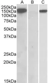 Anti-NALP2 antibody, C-term used in Western Blot (WB). GTX88068