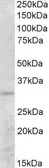 Anti-PEX26 antibody, Internal used in Western Blot (WB). GTX88069