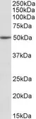 Anti-MON1A antibody, Internal used in Western Blot (WB). GTX88071