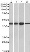 Anti-ACAT1 (aa257-269) antibody, Internal used in Western Blot (WB). GTX88076