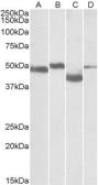 Anti-MEIS2 antibody, Internal used in Western Blot (WB). GTX88079