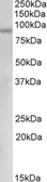 Anti-c-Myb (aa557-569) antibody, Internal used in Western Blot (WB). GTX88080