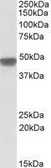 Anti-NDUFS2 antibody, Internal used in Western Blot (WB). GTX88084