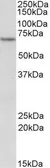 Anti-ETFDH antibody, Internal used in Western Blot (WB). GTX88086