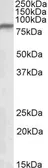 Anti-NDUFS1 antibody, Internal used in Western Blot (WB). GTX88087