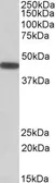 Anti-PBX1 antibody, Internal used in Western Blot (WB). GTX88088