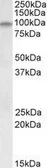 Anti-DAG1 antibody, Internal used in Western Blot (WB). GTX88089