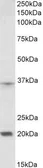 Anti-HOXA9 antibody, Internal used in Western Blot (WB). GTX88092