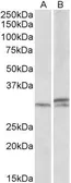 Anti-HOXA9 antibody, Internal used in Western Blot (WB). GTX88093