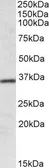Anti-HOXA4 antibody, Internal used in Western Blot (WB). GTX88095