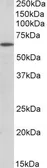 Anti-POU6F2 antibody, N-term used in Western Blot (WB). GTX88096