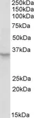 Anti-Peroxin 2 antibody, Internal used in Western Blot (WB). GTX88102