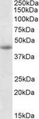 Anti-GNAS antibody, Internal used in Western Blot (WB). GTX88107