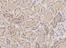 Anti-NIPBL antibody, Internal used in IHC (Paraffin sections) (IHC-P). GTX88110