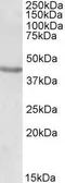 Anti-Brn2 antibody, Internal (near N-term) used in Western Blot (WB). GTX88113