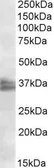 Anti-FRG1 antibody, Internal used in Western Blot (WB). GTX88126