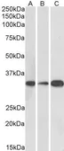 Anti-EB3 (aa151-164) antibody, Internal used in Western Blot (WB). GTX88134
