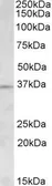 Anti-Aurora C antibody, N-term used in Western Blot (WB). GTX88135
